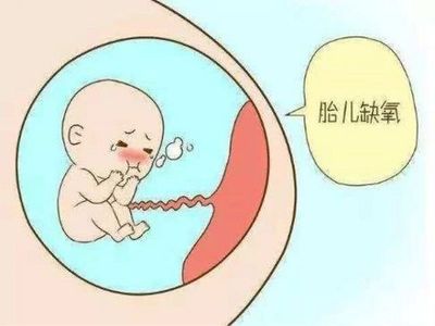 如何知道胎儿是否缺氧