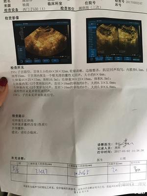 卵泡长不大会怀孕吗