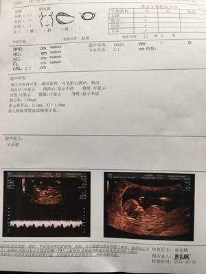 怀孕五周见红怎么回事