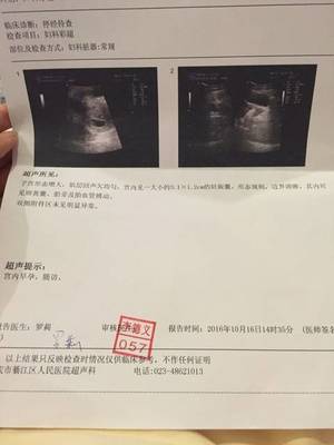 怀孕着床晚是什么意思