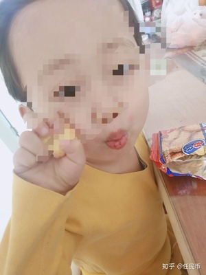 小孩脸疼是怎么回事