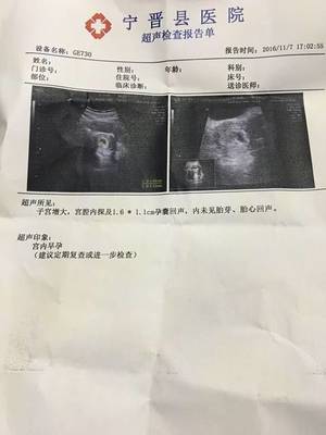 怀孕要多少天