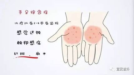 脚趾麻木怎么治疗方法