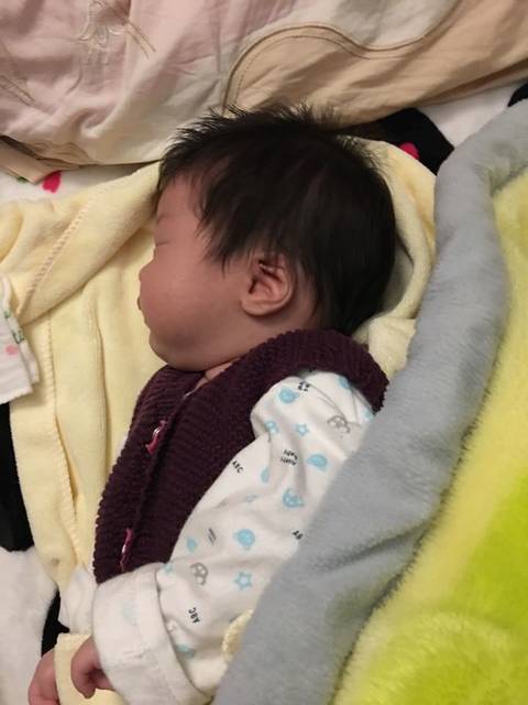 新生儿头有点尖怎么办