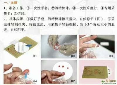 医院亲子鉴定挂什么科