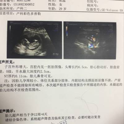 四个半月的胎儿有多大
