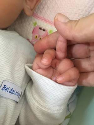宝宝发烧手心脚心出汗