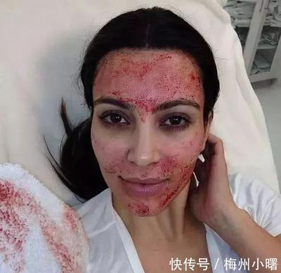 换血美容