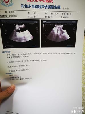 孕囊里没有胚芽是怎么回事