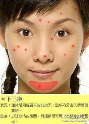内分泌引起痘痘如何祛痘