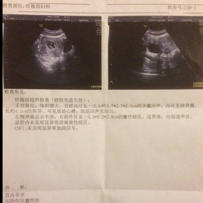 怀孕8周胎儿图片欣赏