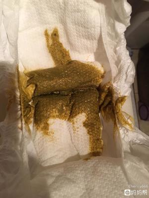 两个月的婴儿拉绿屎是怎么回事