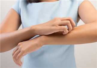 孕妇荨麻疹如何治疗