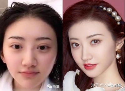 割了双眼皮后特后悔