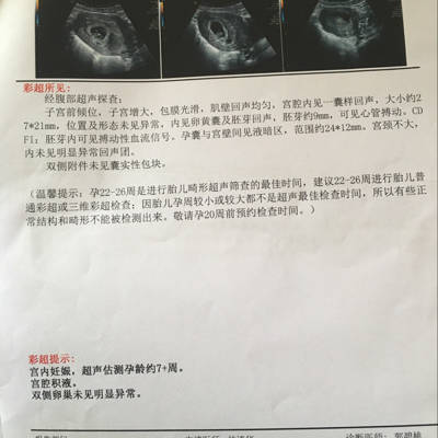 吃孕酮对胎儿有影响吗
