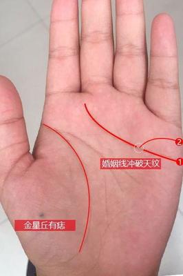 婚姻线有痣