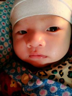 两个月婴儿贫血
