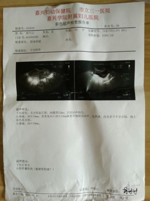 输卵管有积液是怎么回事