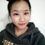 镇江割双眼皮