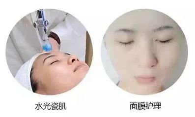 瓷肌去痘痘