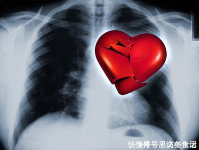 心脏不好会咳嗽吗