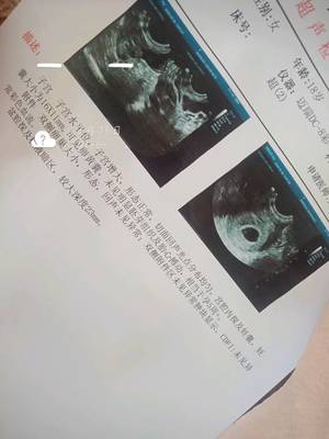怀孕初期肚子会痛吗