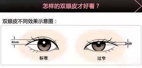 双眼皮做美瞳线好看吗