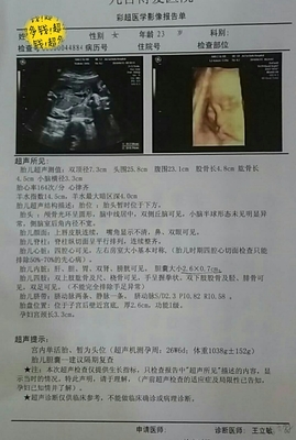 胎儿头偏大是什么原因