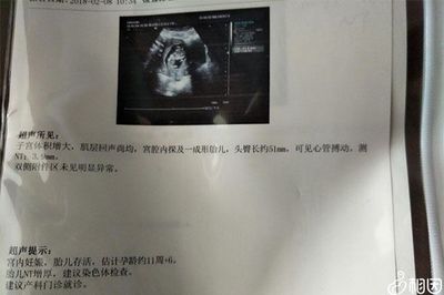 nt检查胎儿心跳多少正常值是多少