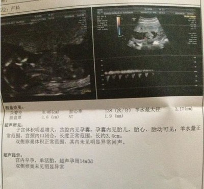 怀孕4周会恶心吗
