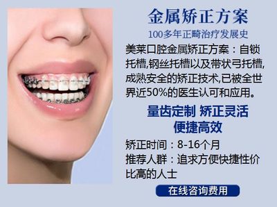牙齿矫正上海美莱领先