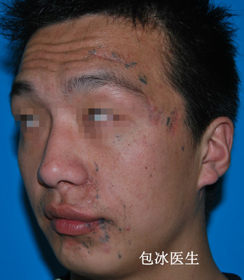 口唇白是怎么回事