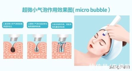 做完小气泡可以化妆吗