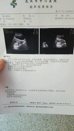两个月没有胎心