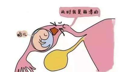 宫颈息肉会影响胎儿吗