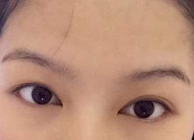 桃花眼必须是双眼皮吗