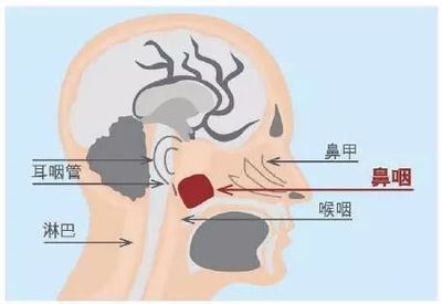 鼻癌放疗要多少钱