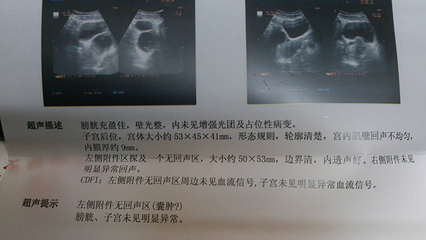 卵巢囊肿还能怀孕吗