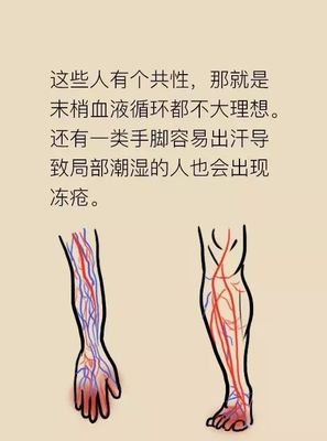 手脚潮湿是怎么回事