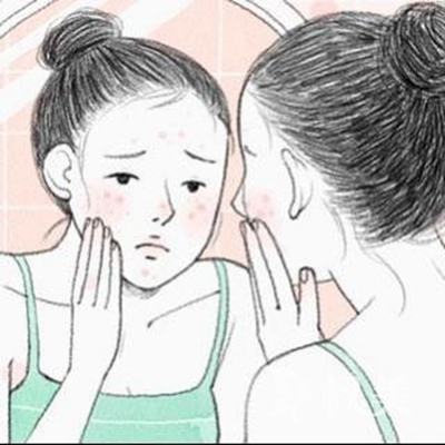 总长痘痘怎么治疗