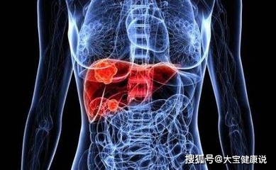 脂肪肝酒精肝怎么治疗