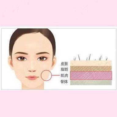 第一次打瘦脸针没效果
