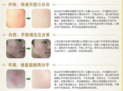 快速灭痘痘