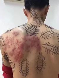 左上后背疼是怎么回事
