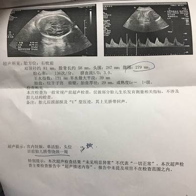 32周胎儿