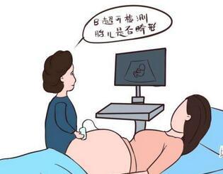 有什么方法可以不怀孕