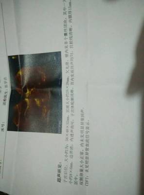 怀孕老咳嗽怎么办