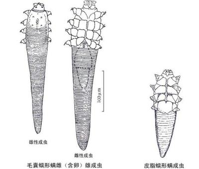鼻子上小痘痘为什么会痛