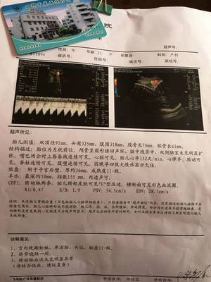 怀孕36周孩子一般几斤