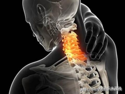 颈椎累是怎么回事儿